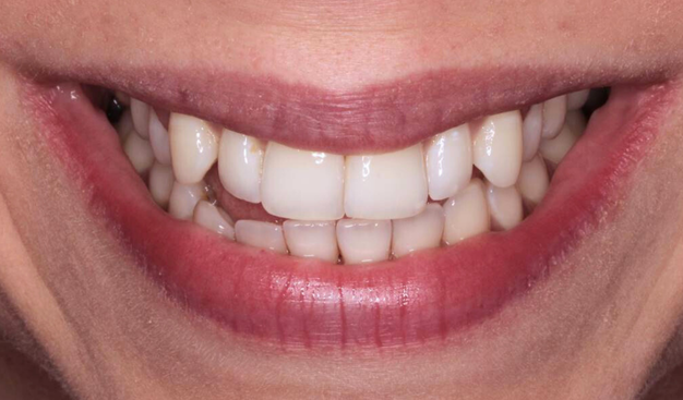 Before - Dr Nina Shaffie