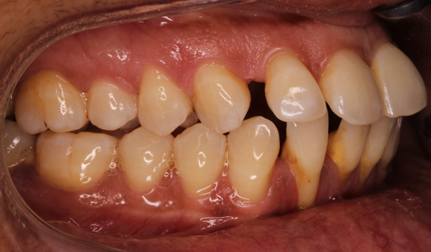 Before - Dr Nina Shaffie