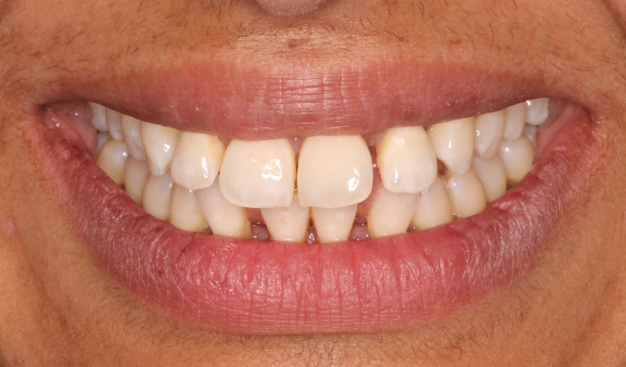 Before - Dr Nina Shaffie