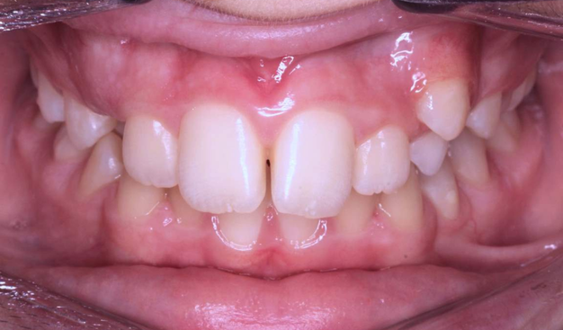 Before - Dr Nina Shaffie