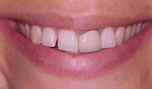 Before - Dr Nina Shaffie