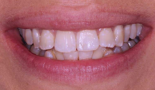 Before - Dr Nina Shaffie