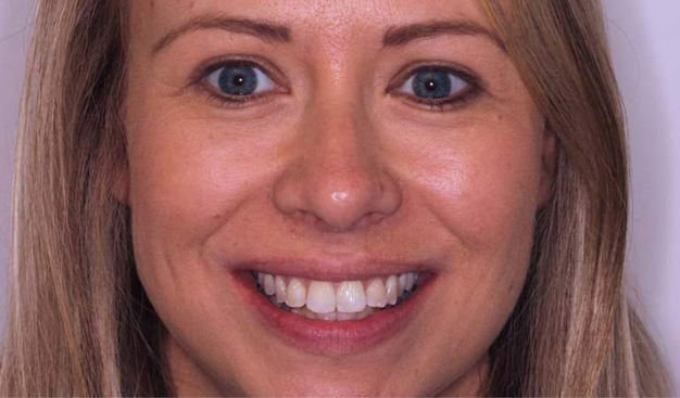 Before - Dr Nina Shaffie