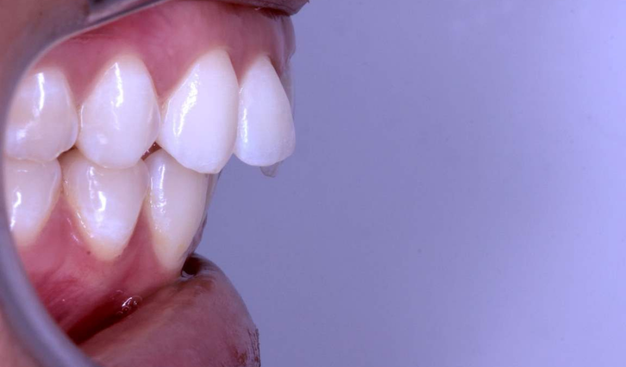 Before - Dr Nina Shaffie