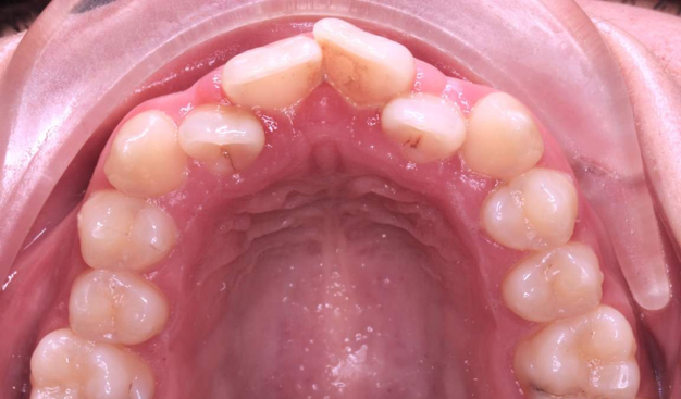 Before - Dr Nina Shaffie