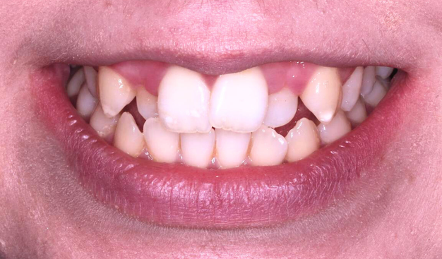 Before - Dr Nina Shaffie