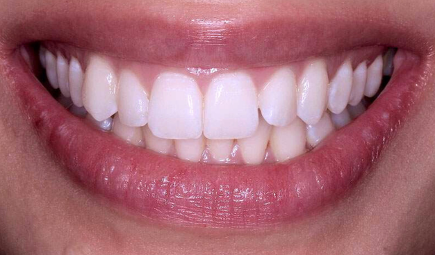 Before - Dr Nina Shaffie