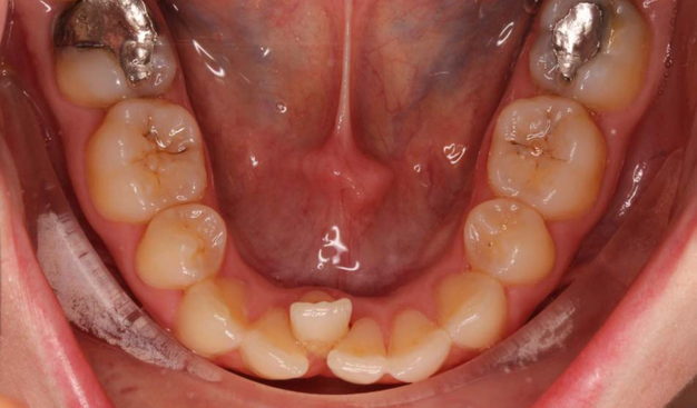 Before - Dr Nina Shaffie