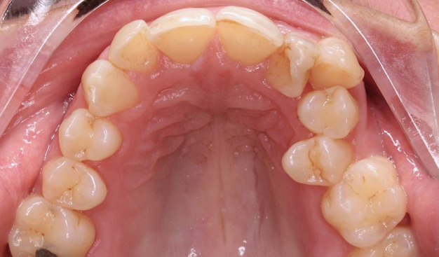 Before - Dr Nina Shaffie