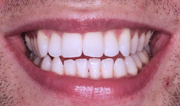 Before - Dr Nina Shaffie