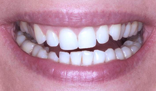 Before - Dr Nina Shaffie