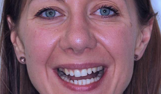 Before - Dr Nina Shaffie