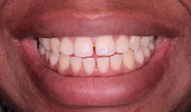 Before - Dr Nina Shaffie