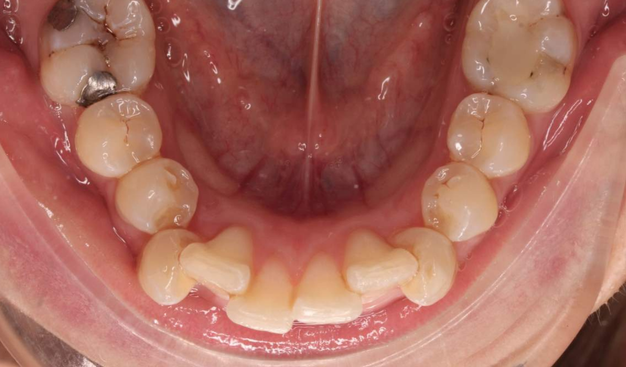 Before - Dr Nina Shaffie