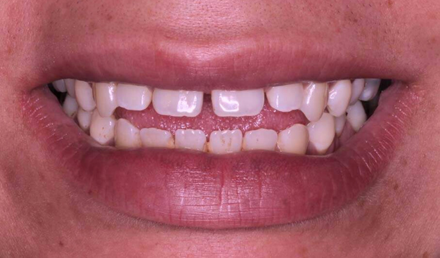 Before - Dr Nina Shaffie