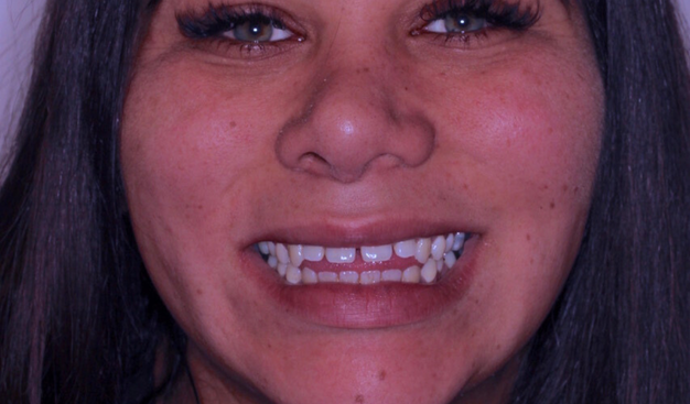 Before - Dr Nina Shaffie