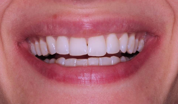 Before - Dr Nina Shaffie