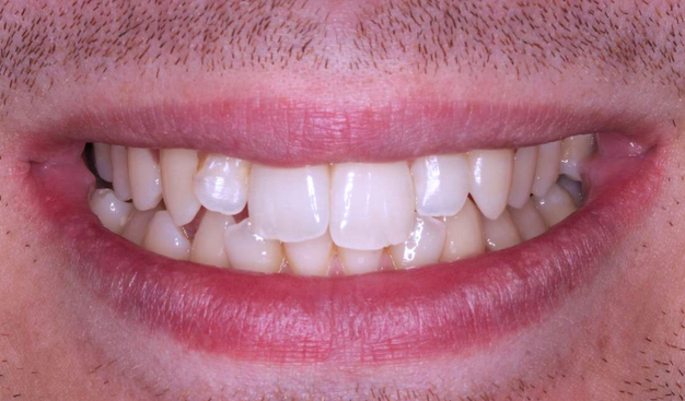 Before - Dr Nina Shaffie