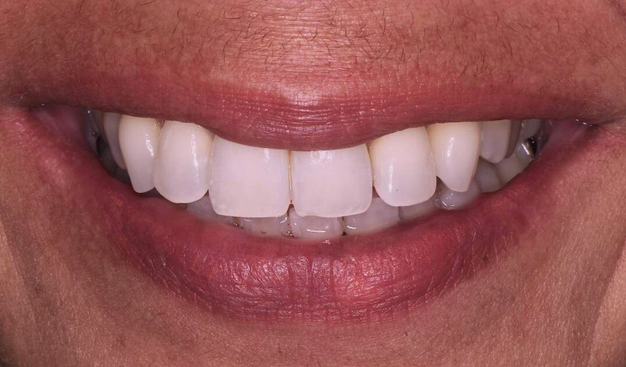 Before - Dr Nina Shaffie