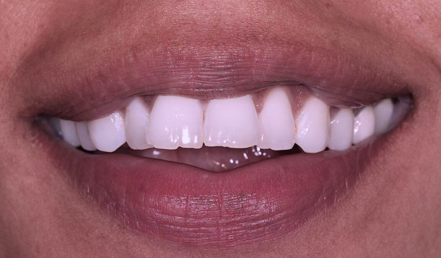 Before - Dr Nina Shaffie