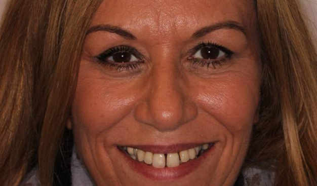 Before - Dr Nina Shaffie