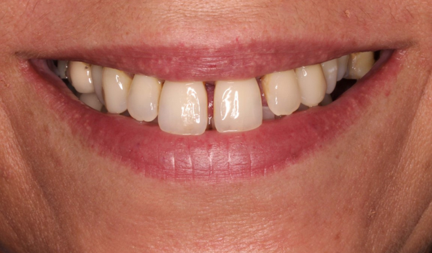 Before - Dr Nina Shaffie