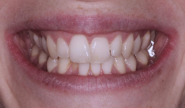 Before - Dr Nina Shaffie