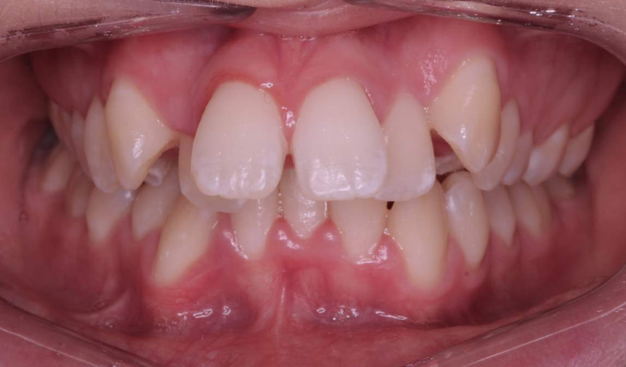 Before - Dr Nina Shaffie