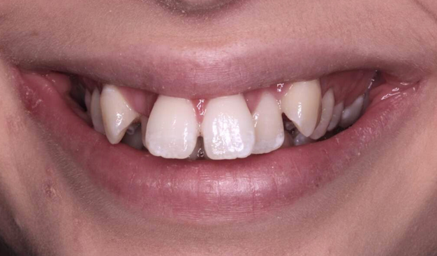 Before - Dr Nina Shaffie