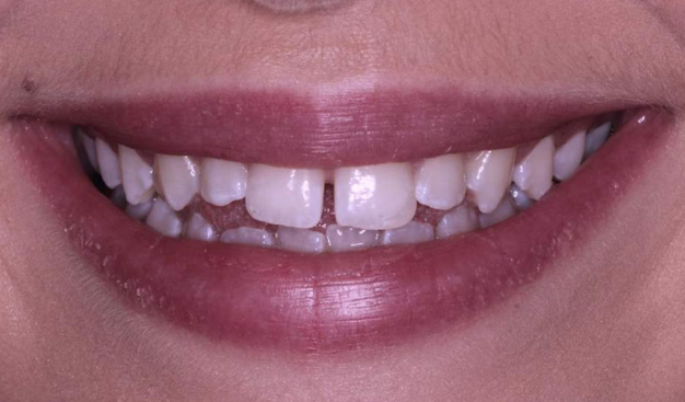 Before - Dr Nina Shaffie