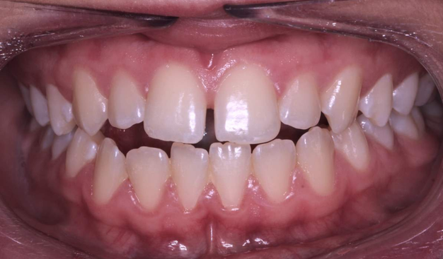 Before - Dr Nina Shaffie