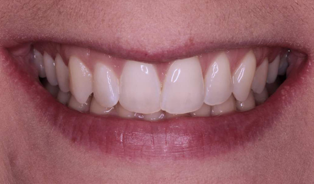 Before - Dr Nina Shaffie