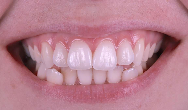 Before - Dr Nina Shaffie