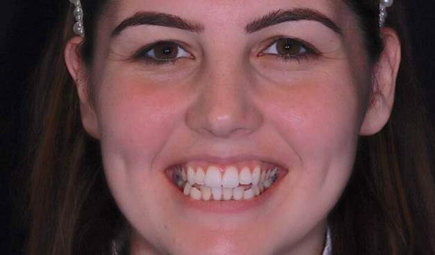 Before - Dr Nina Shaffie