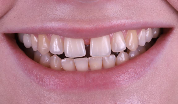 Before - Dr Nina Shaffie