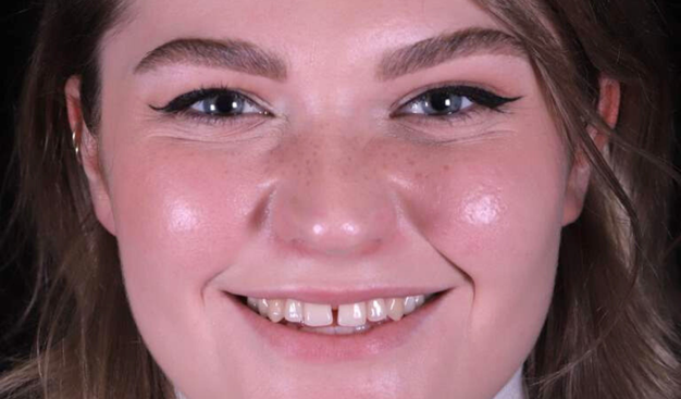 Before - Dr Nina Shaffie