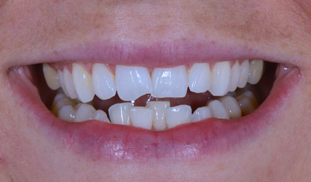 Before - Dr Nina Shaffie