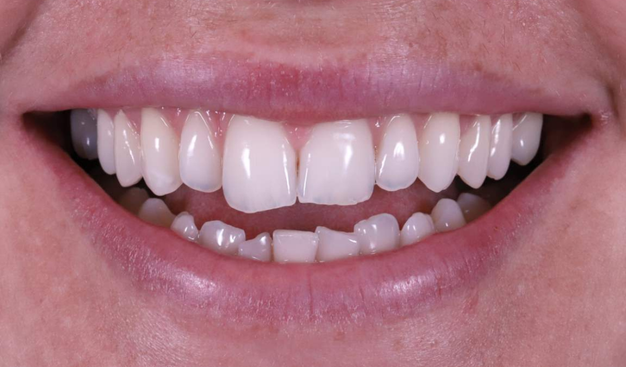 Before - Dr Nina Shaffie