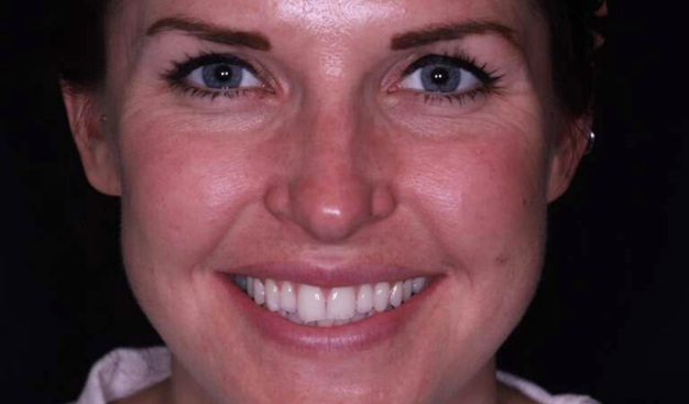 Before - Dr Nina Shaffie