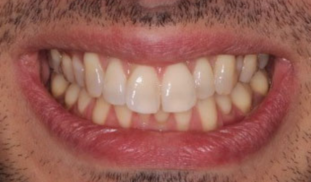 Before - Dr Nina Shaffie