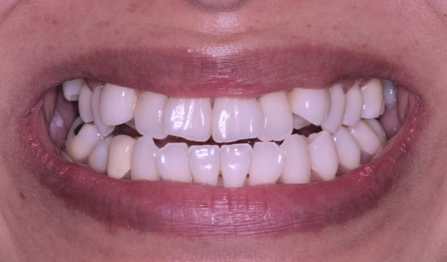 Before - Dr Nina Shaffie