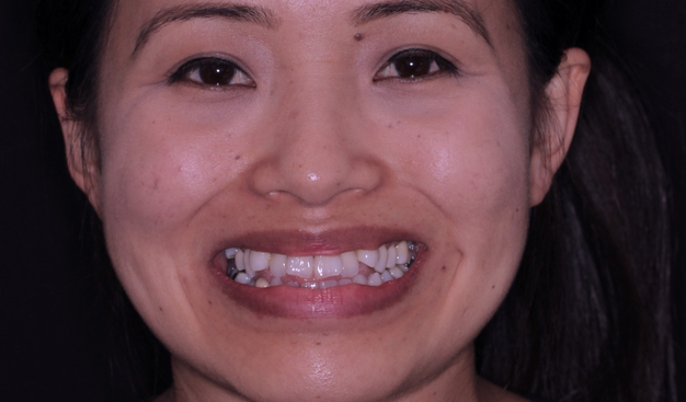 Before - Dr Nina Shaffie