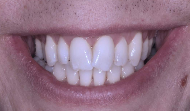 Before - Dr Nina Shaffie