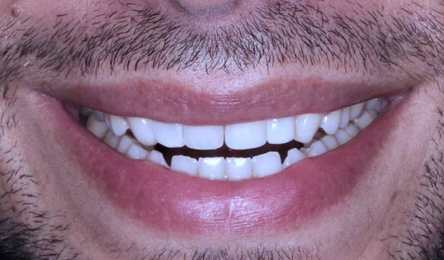 Before - Dr Nina Shaffie