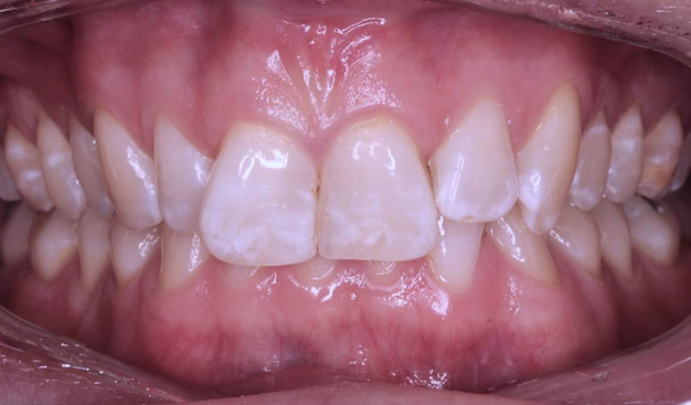 Before - Dr Nina Shaffie