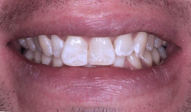 Before - Dr Nina Shaffie