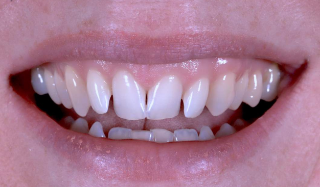 Before - Dr Nina Shaffie