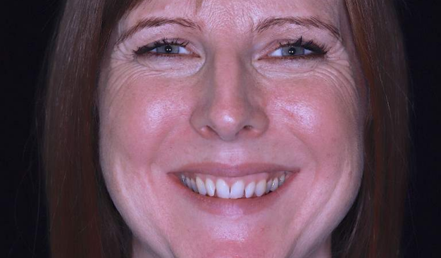 Before - Dr Nina Shaffie