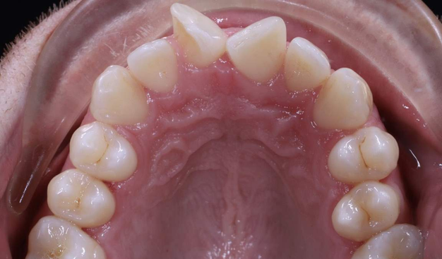 Before - Dr Nina Shaffie