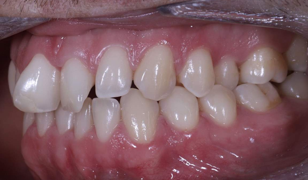 Before - Dr Nina Shaffie